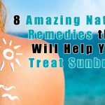 8 Amazing Natural Remedies that Will Help You Treat Sunburn1